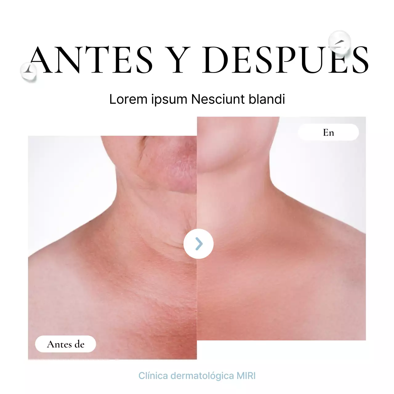 Revisión hospitalaria del antes y el después de un anuncio para promocionar una sencilla consulta de dermatología en blanco y azul claro