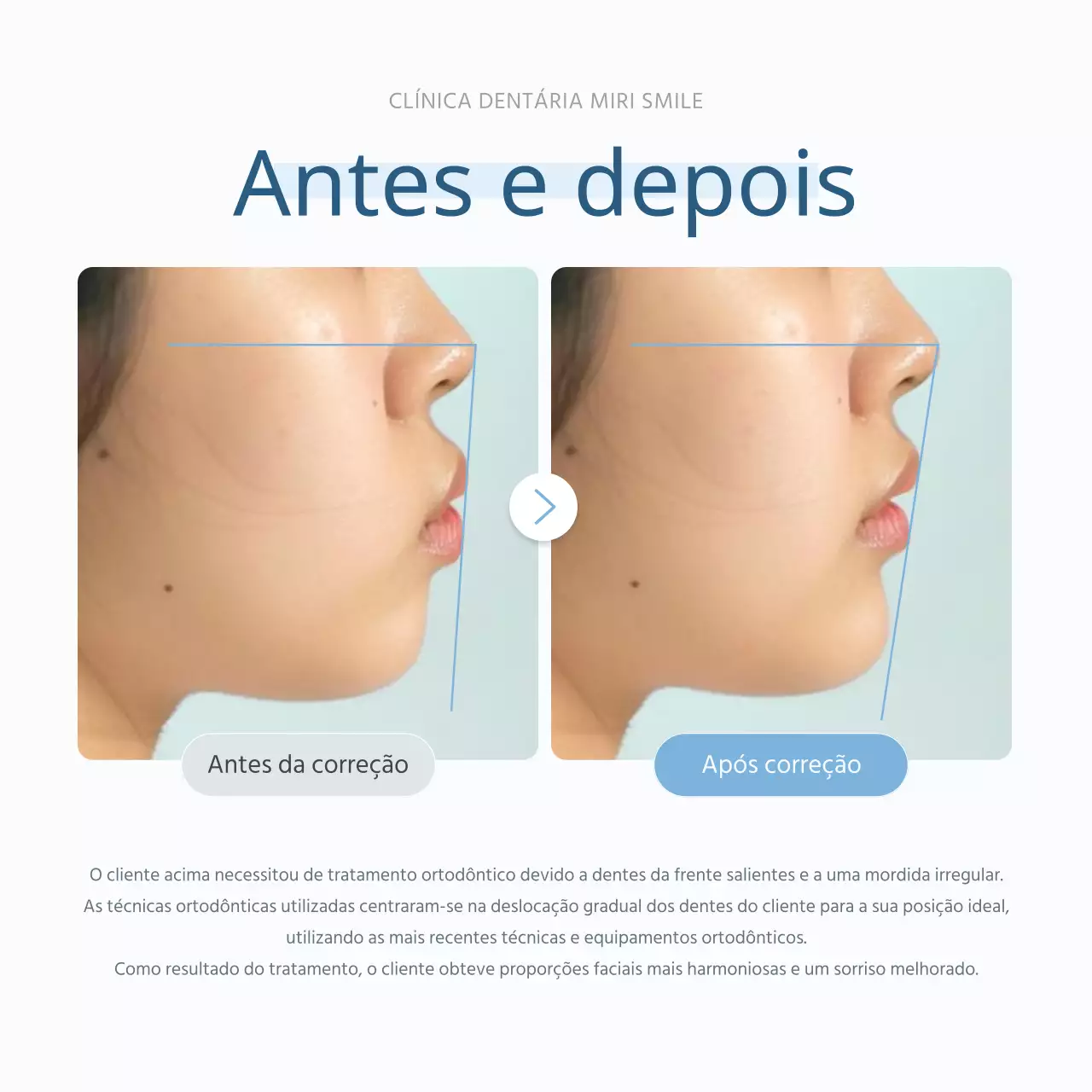 Análise do hospital antes e depois para promover um consultório dentário simples, branco e azul claro
