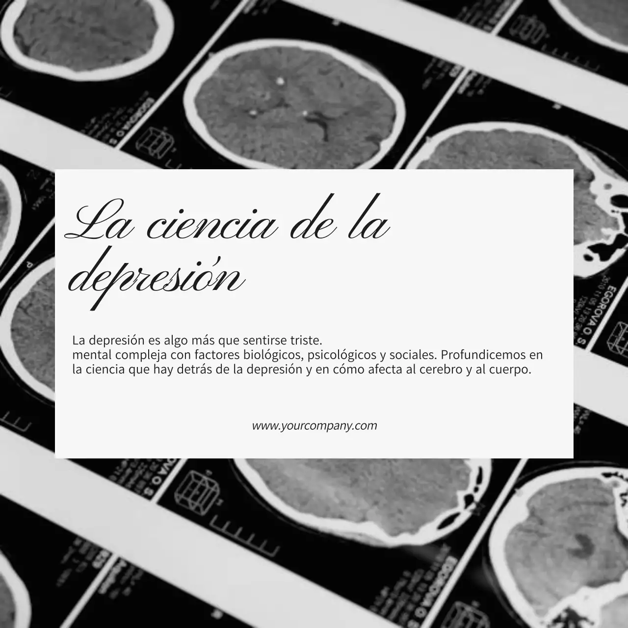 Blanco y negro de moda Promoción del blog de atención mental