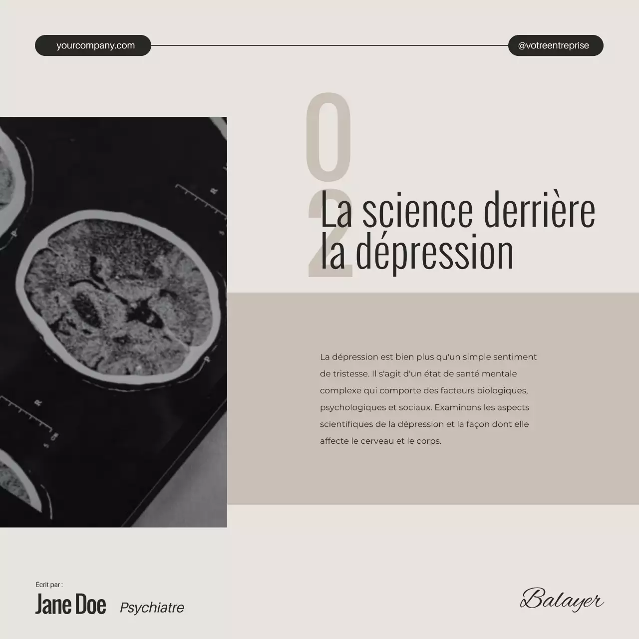 Campagne Ivory Black and White Minimal Mental Health Depression Unveiled (en anglais)