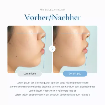 Vorher-Nachher-Bilanz eines Krankenhauses zur Förderung einer einfachen weiß-hellblauen Zahnarztpraxis