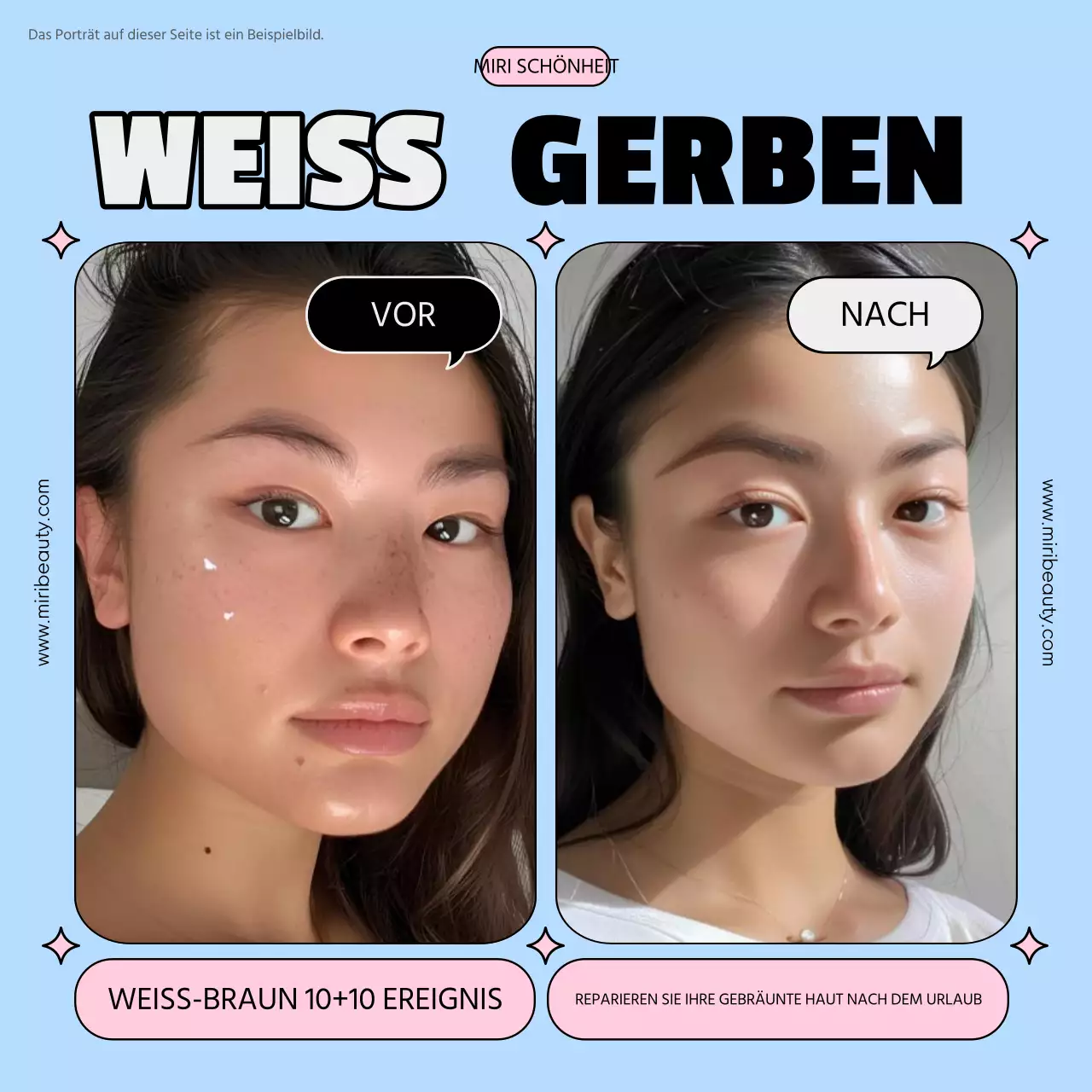 Fördern Sie hellblaue und rosa trendige Haut und weiße Bräune