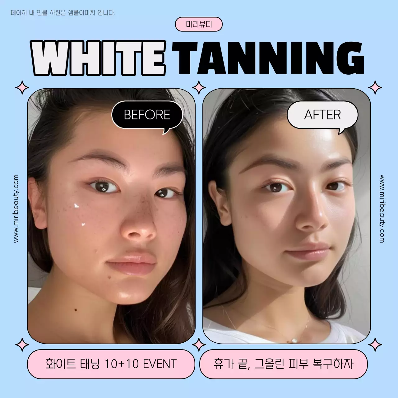 하늘색과 핑크색의 트렌드한 피부과 화이트 태닝 홍보
