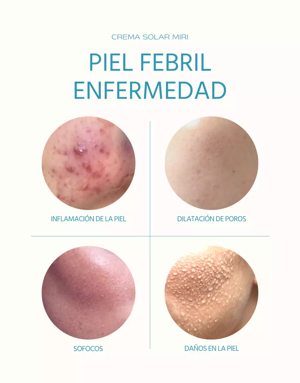 Un simple protector solar en azul claro y naranja explicado