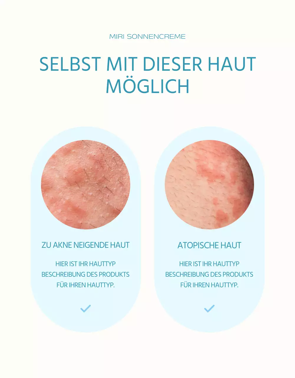 Ein einfacher Sonnenschutz in Hellblau und Orange erklärt