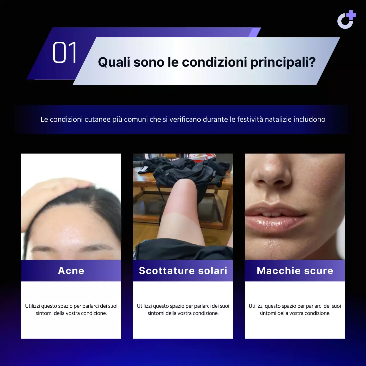 Una semplice guida viola per prevenire le malattie della pelle in vacanza