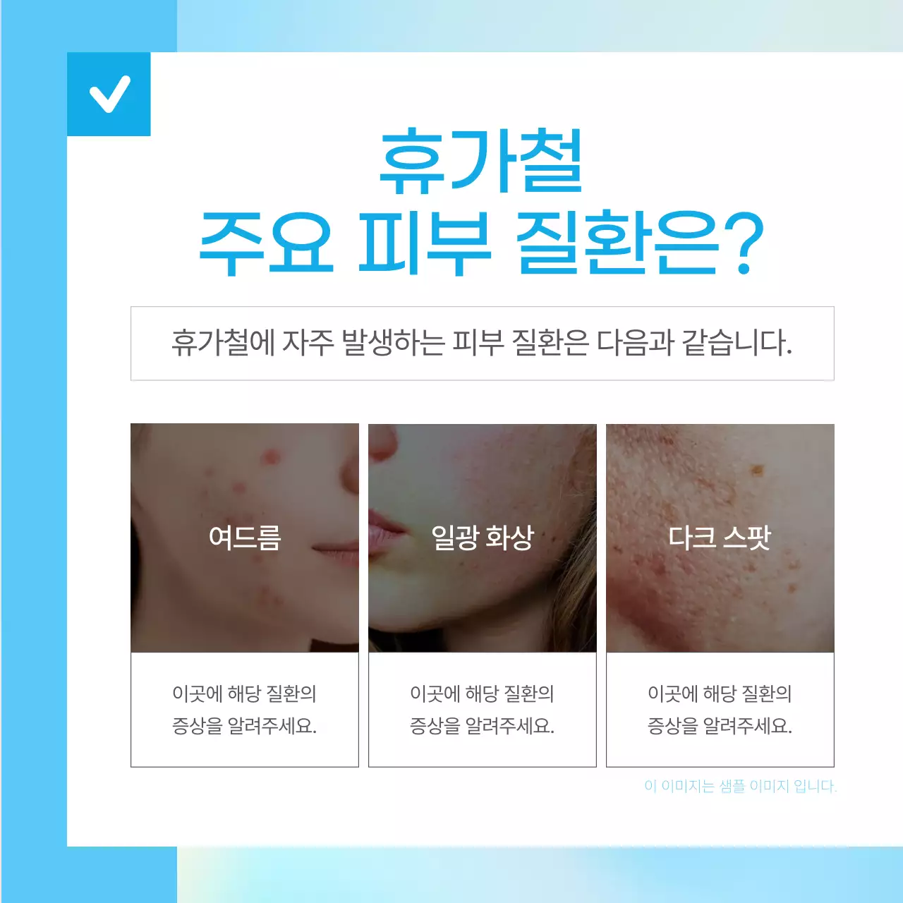 하늘색의 단순한 휴가철 피부 질환 예방 정보