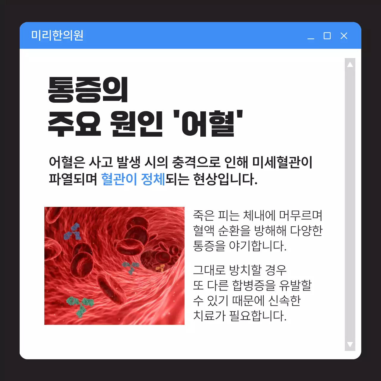 파랑과 검정의 UI 스타일 교통사고 후유증 정보