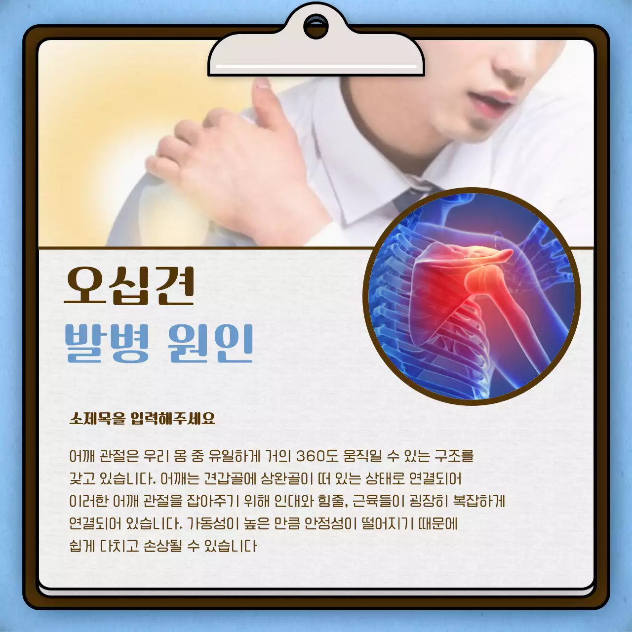 하늘색 브라운의 한방 병원 차트 컨셉의 오십견 안내