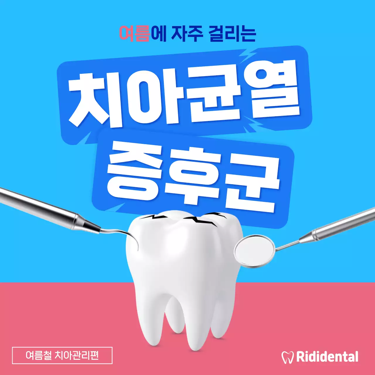 하늘색과 분홍색의 깔끔한 치아균열 증후군