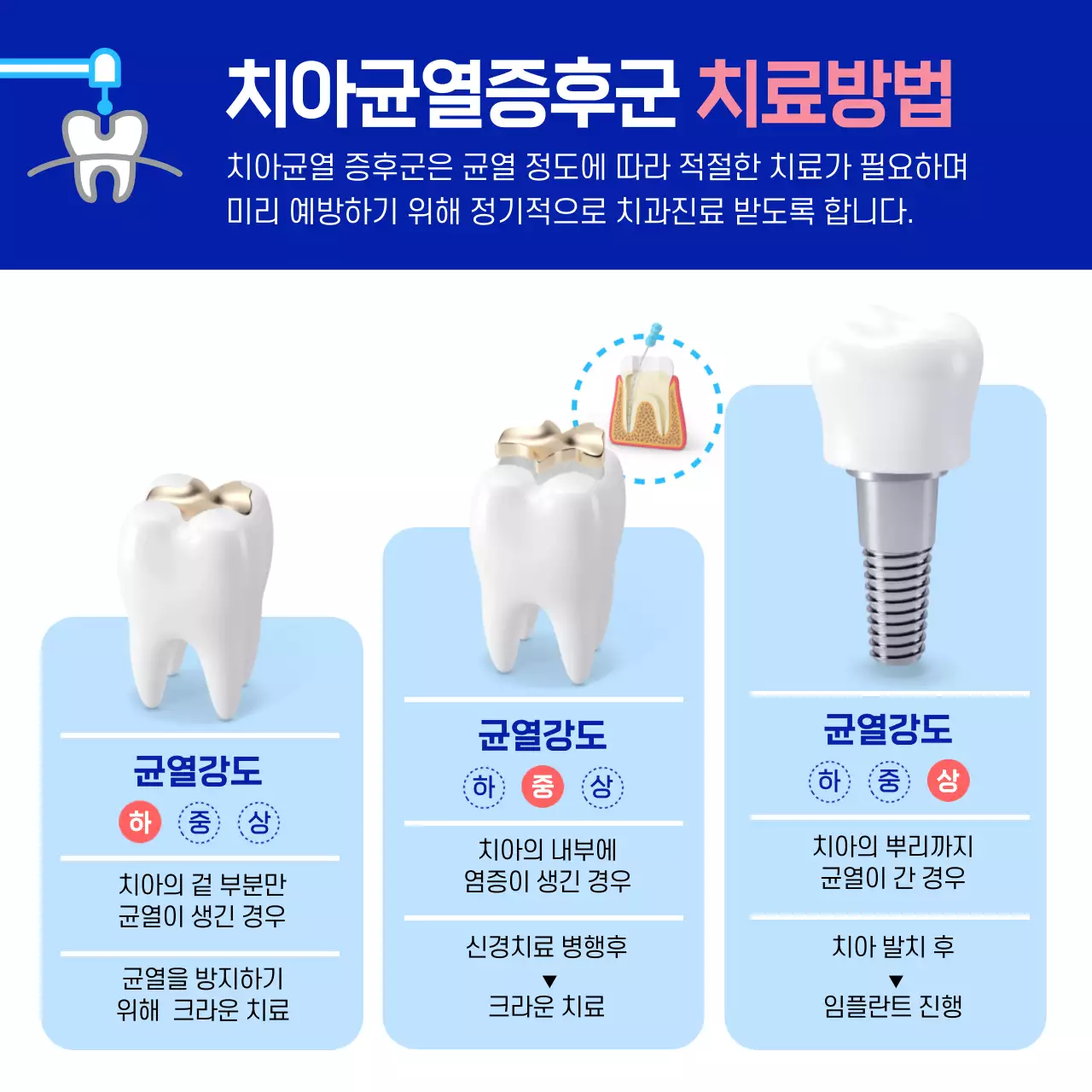 하늘색과 분홍색의 깔끔한 치아균열 증후군