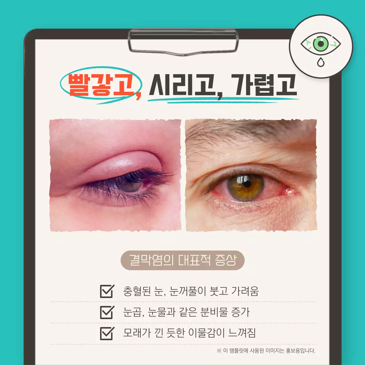 청록색과 남색의 여름 질병 정보