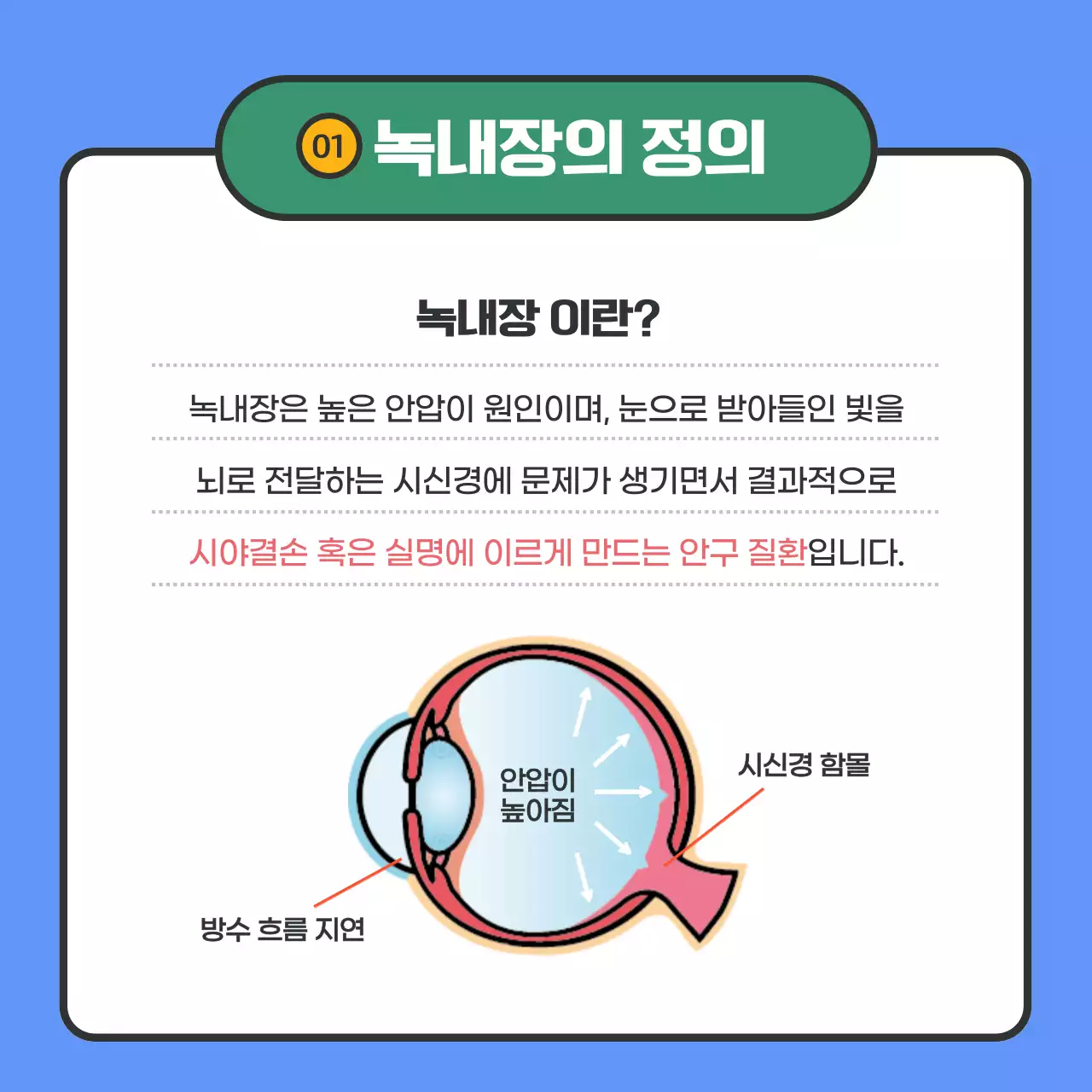 파란색의 텍스트 강조의 녹내장 정보 제공