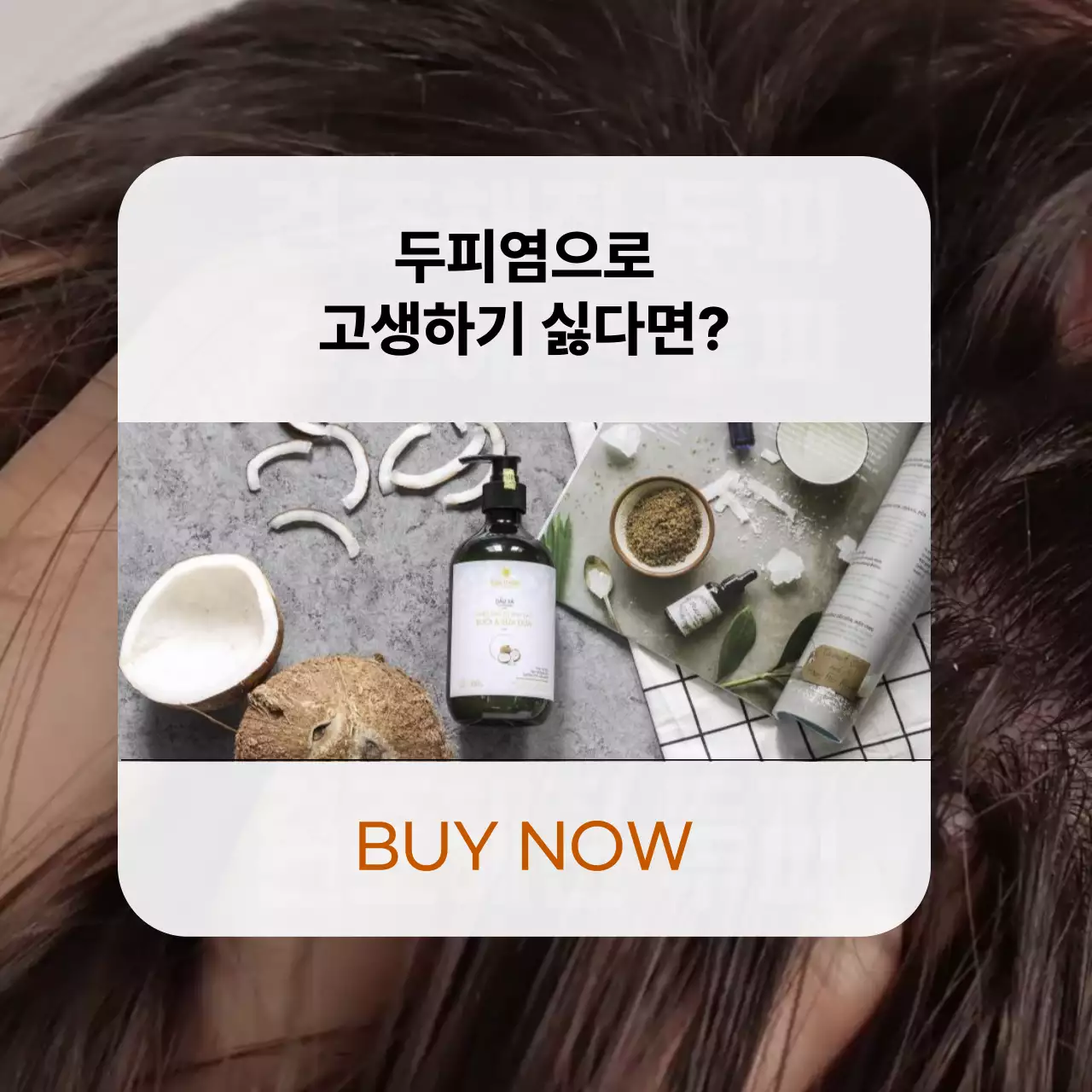 갈색의 팝업 컨셉의 환절기 두피 케어 광고