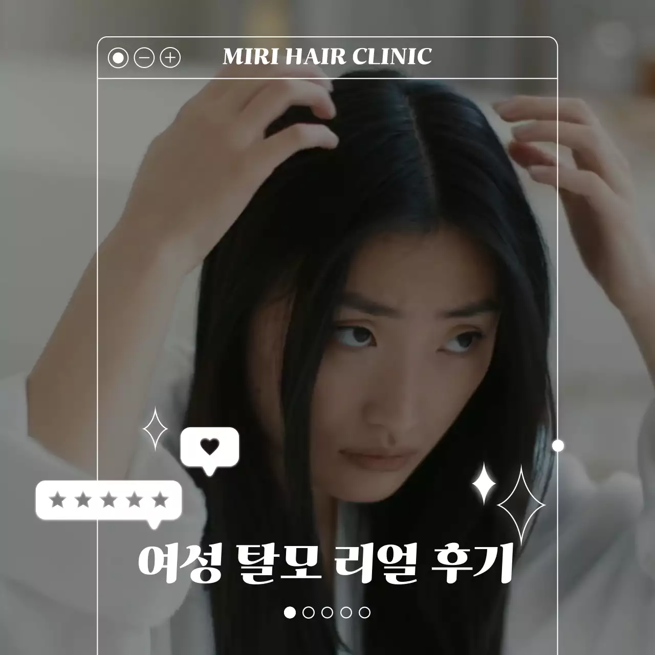 화이트 팝업창의 깔끔한 여성 탈모 리얼 후기