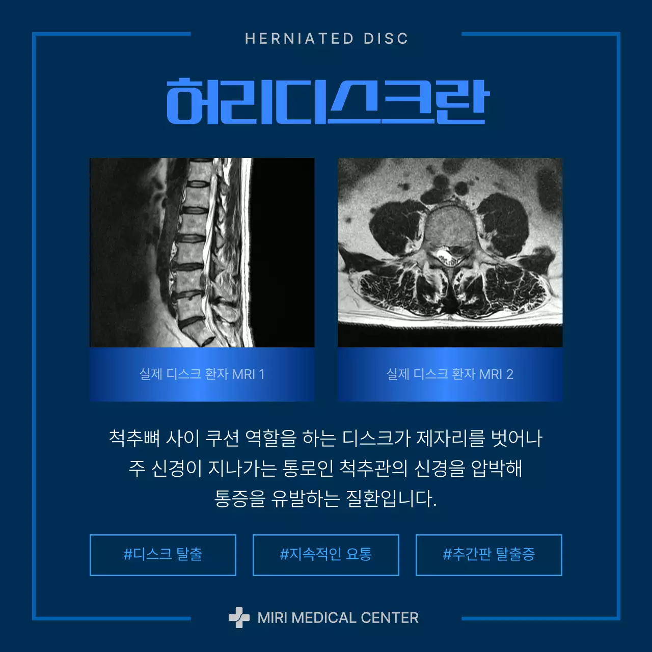 파란색과 남색의 모던한 허리디스크 정보