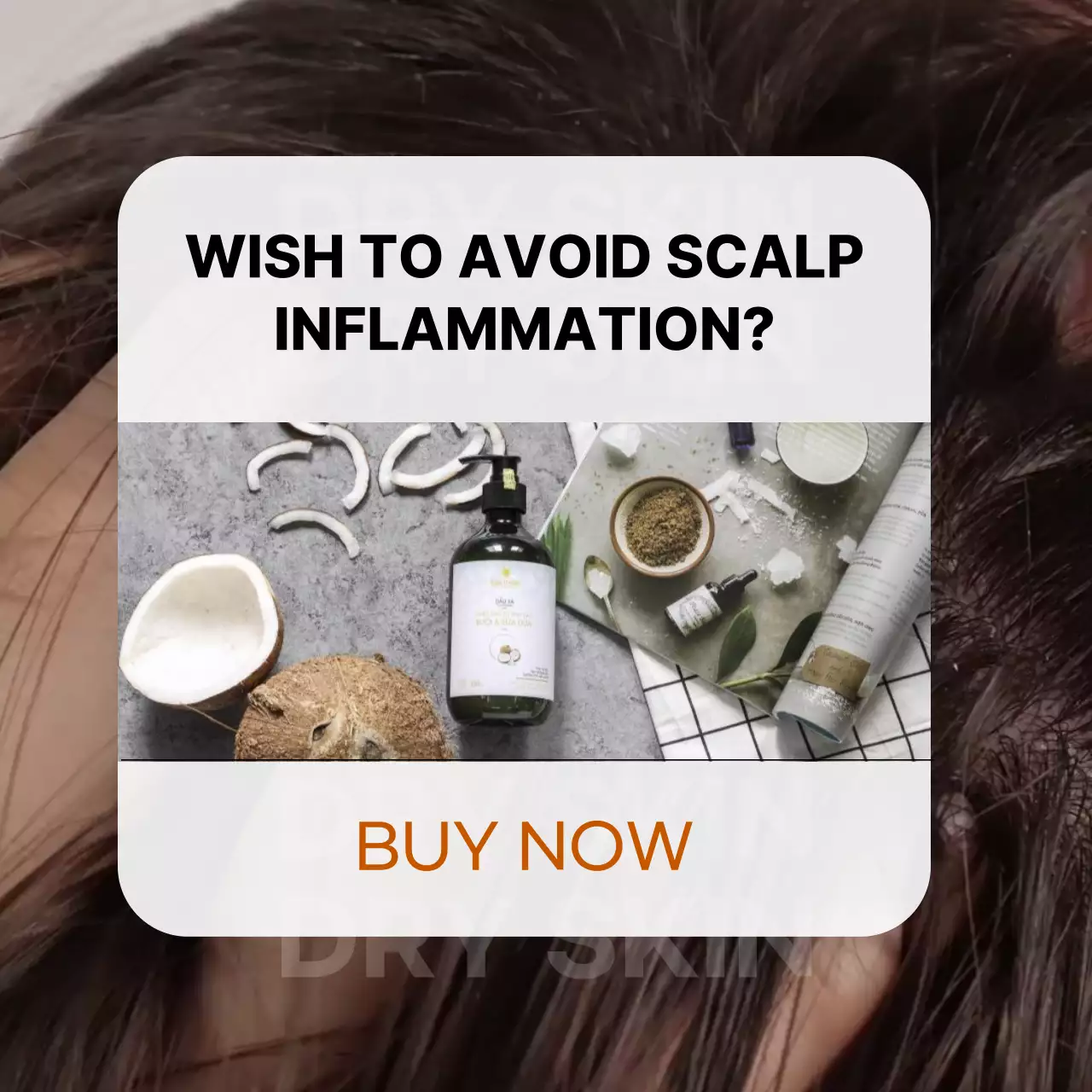 갈색의 팝업 컨셉의 환절기 두피 케어 광고