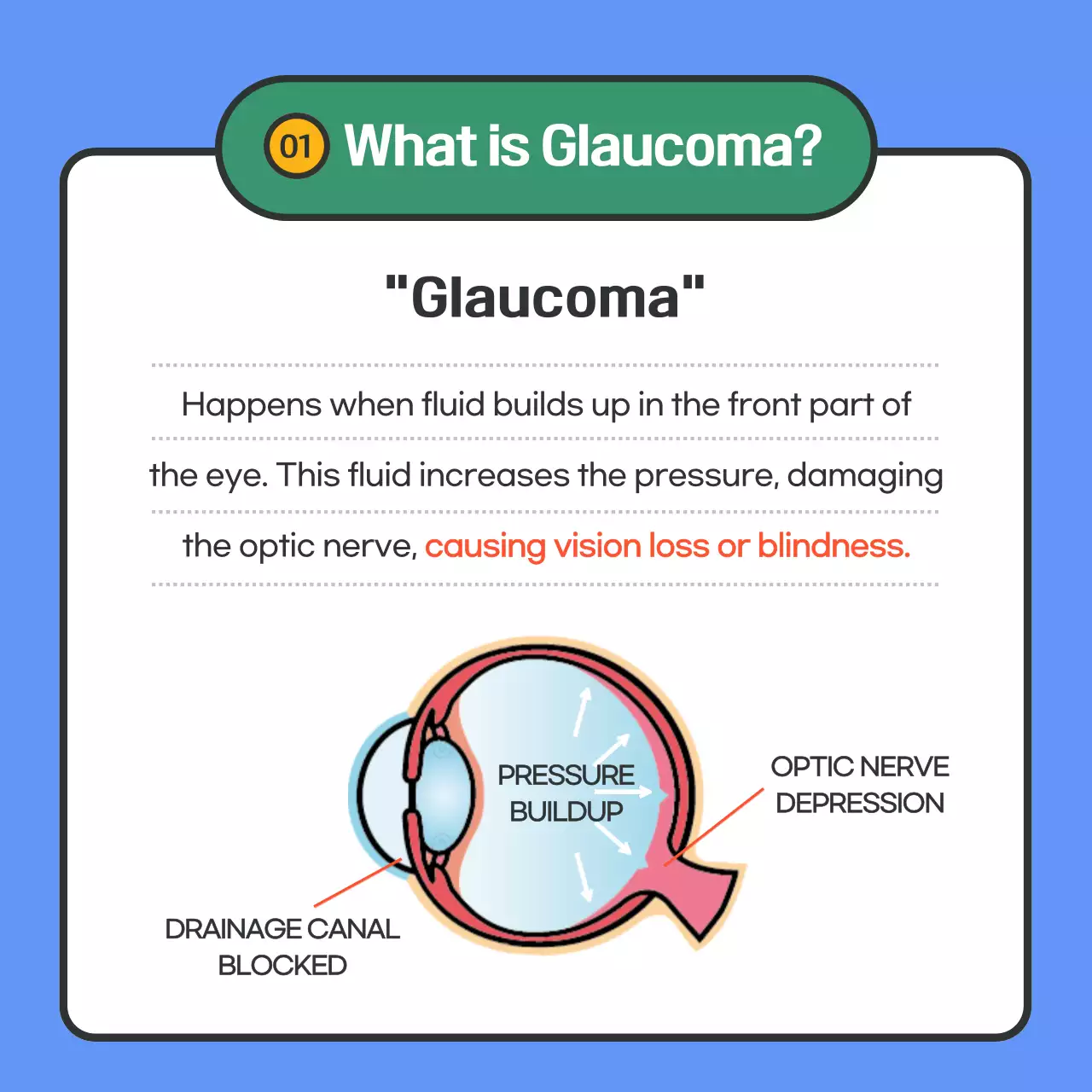 Provides glaucoma information in blue text highlighting