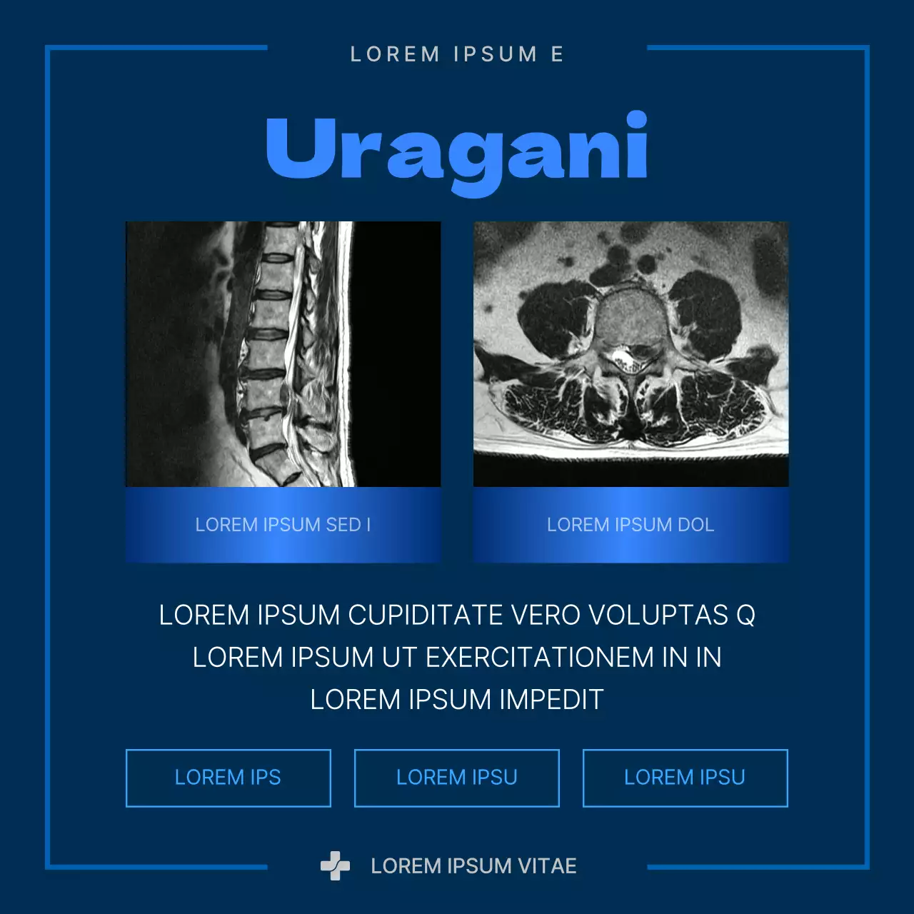 Informazioni sull'ernia del disco moderna blu e marina