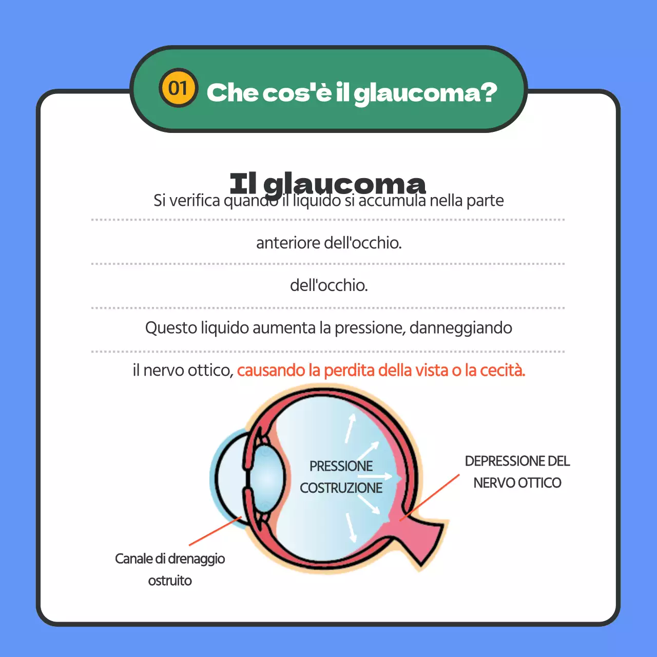 Fornisce informazioni sul glaucoma con evidenziazione del testo in blu