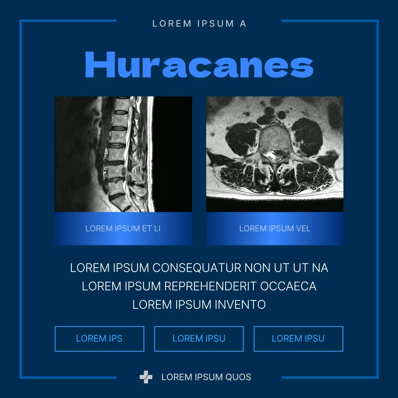 Sobre la hernia discal moderna azul y azul marino