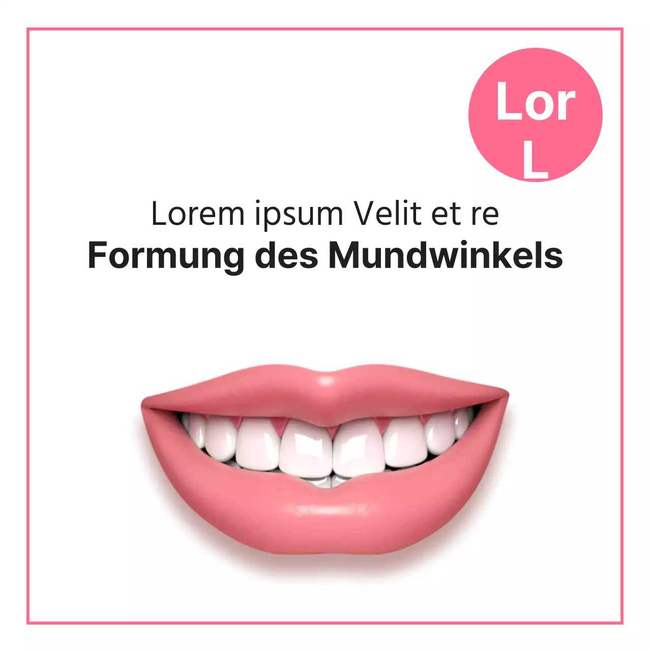 Modellierung des Mundwinkels