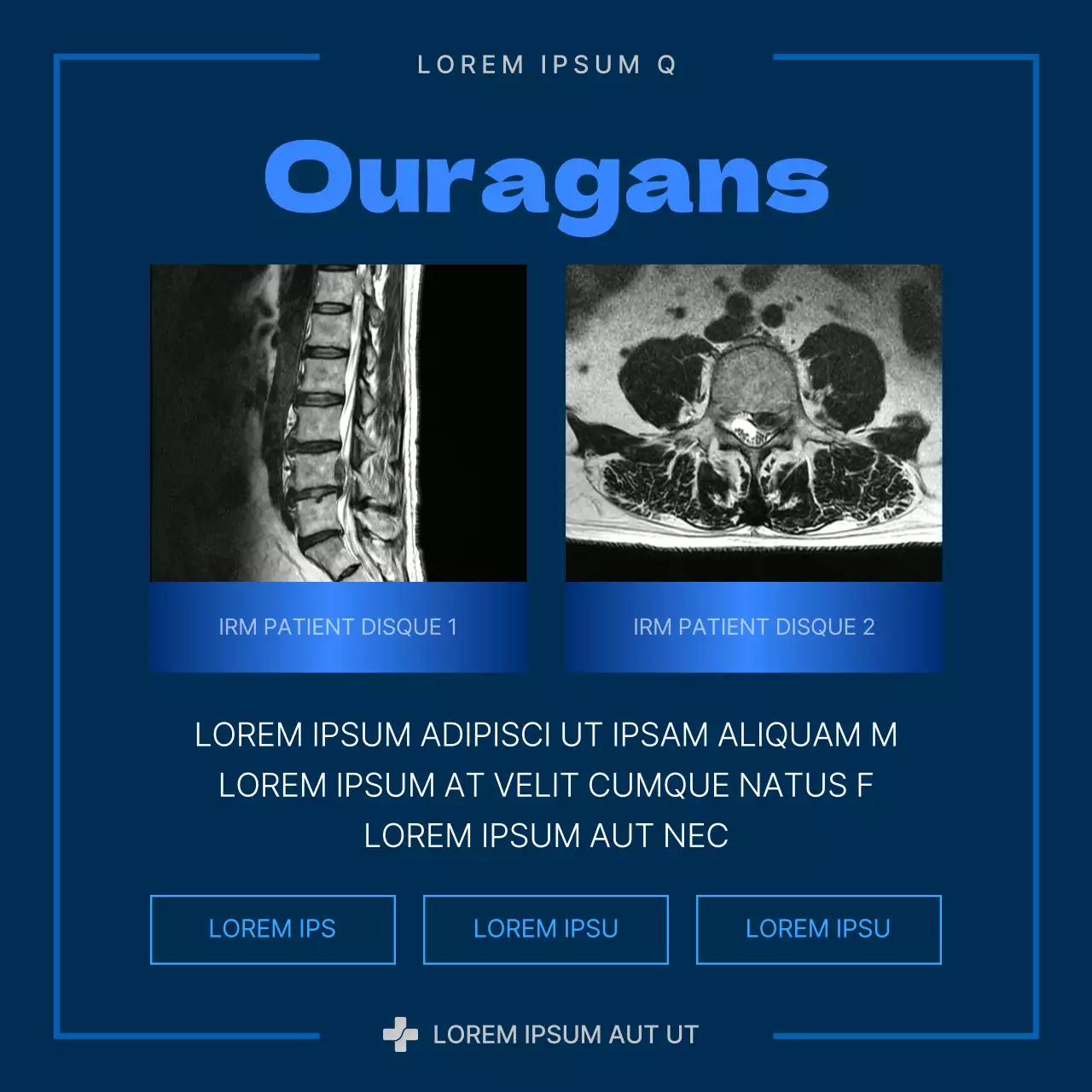 A propos de la hernie discale moderne bleu et marine