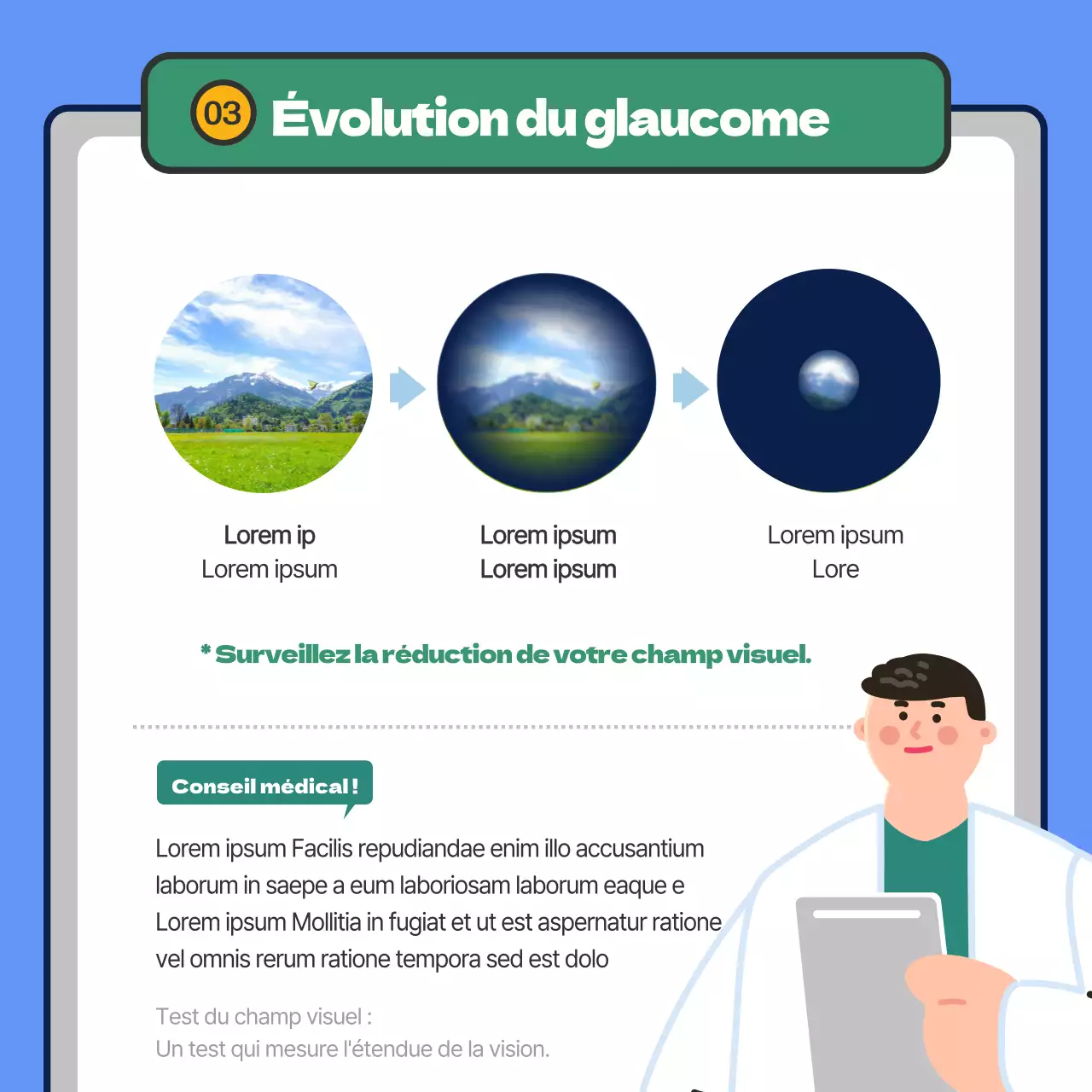 Fournit des informations sur le glaucome en surbrillance bleue.