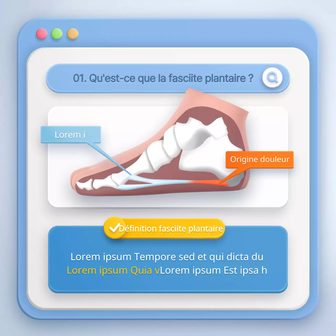 Concept de navigateur stéréoscopique dans la fasciite plantaire bleu clair et jaune