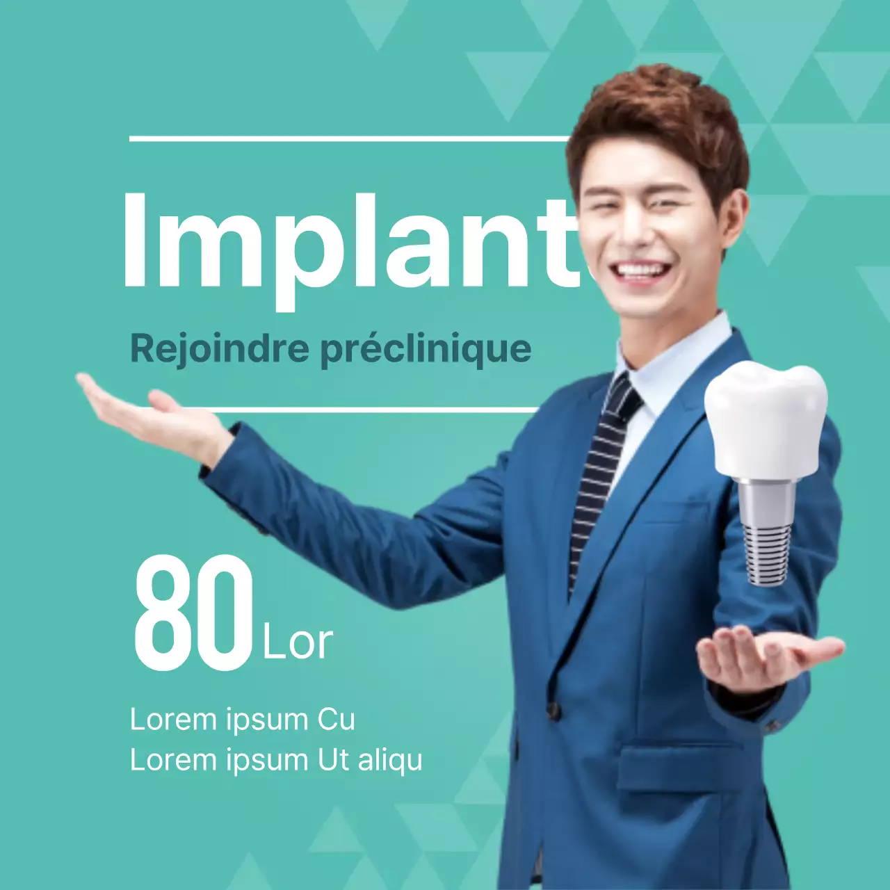Implants