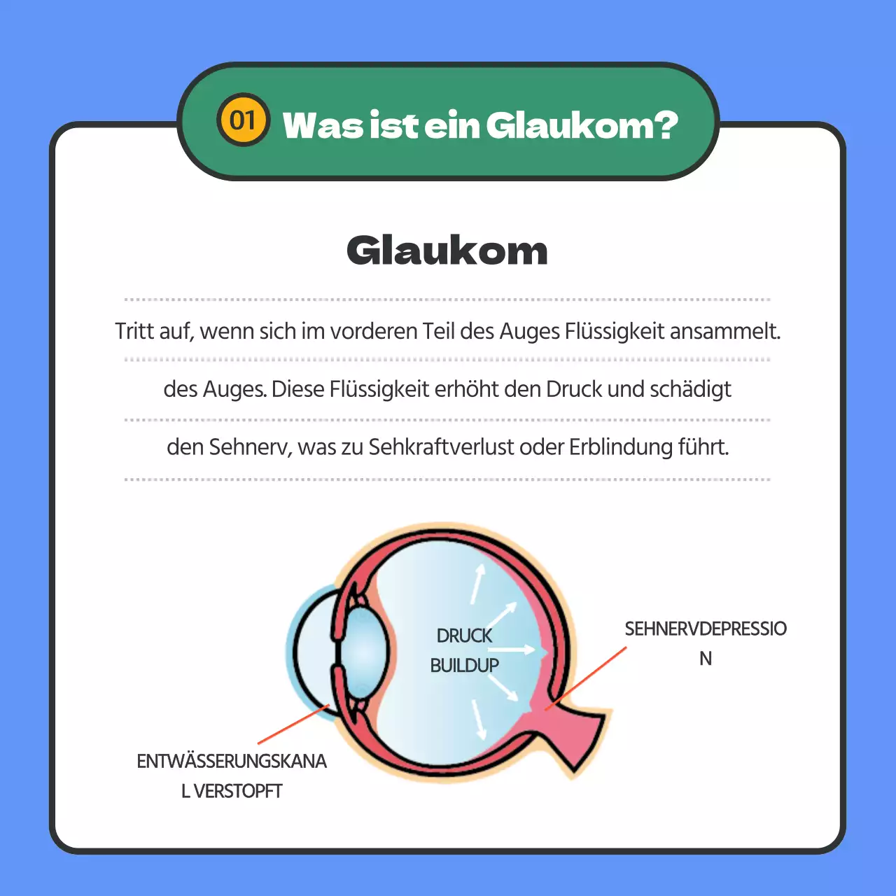 Bietet Glaukom-Informationen in blau hervorgehobenem Text