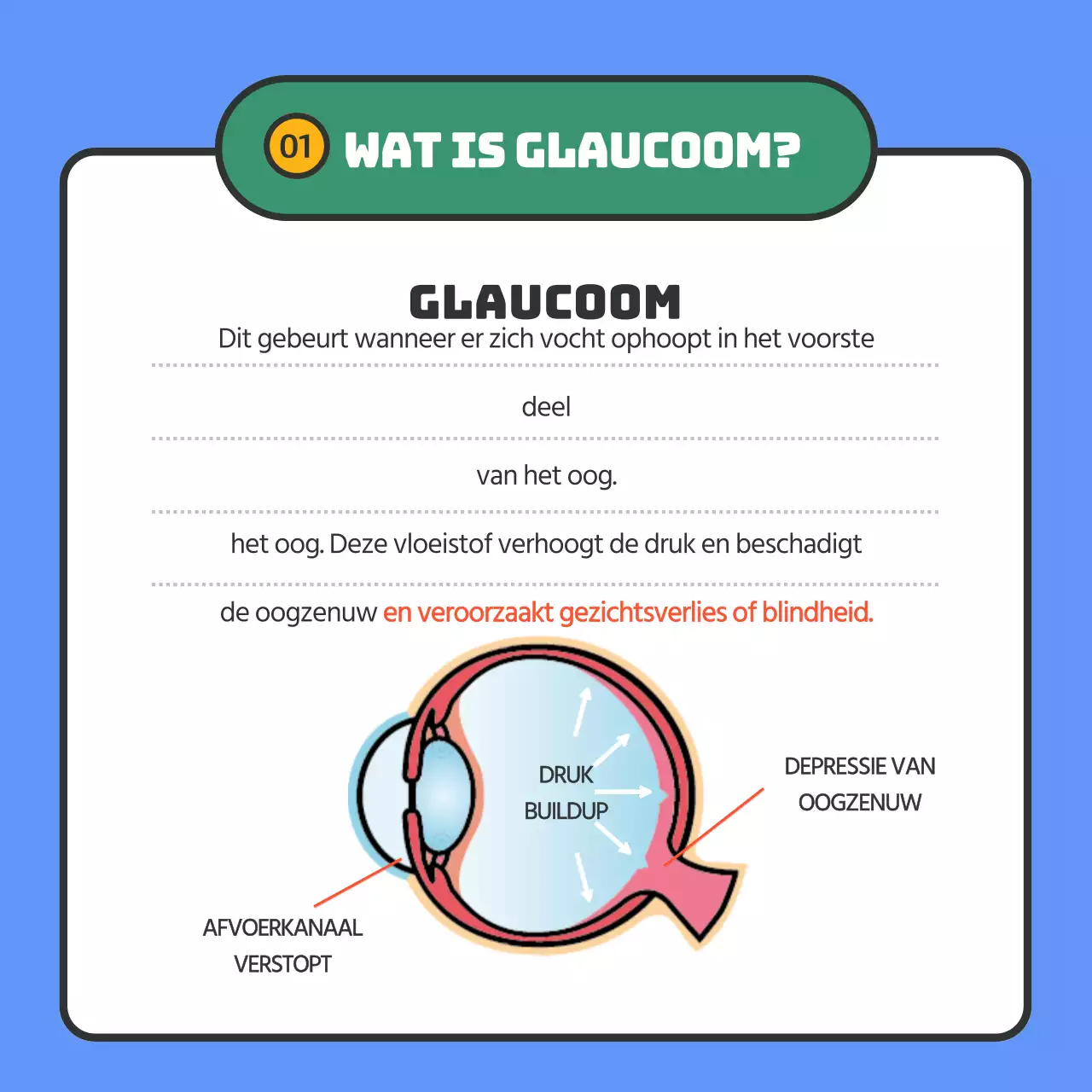 Geeft informatie over glaucoom in blauwe tekstmarkering