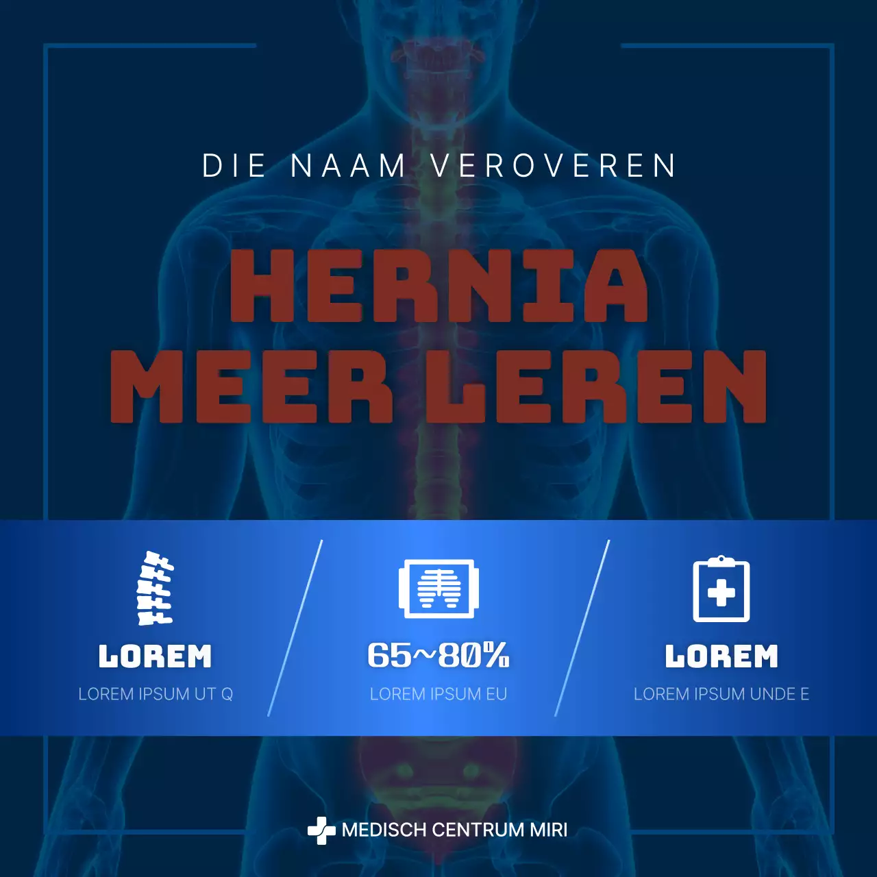 Over de blauwe en marine moderne hernia