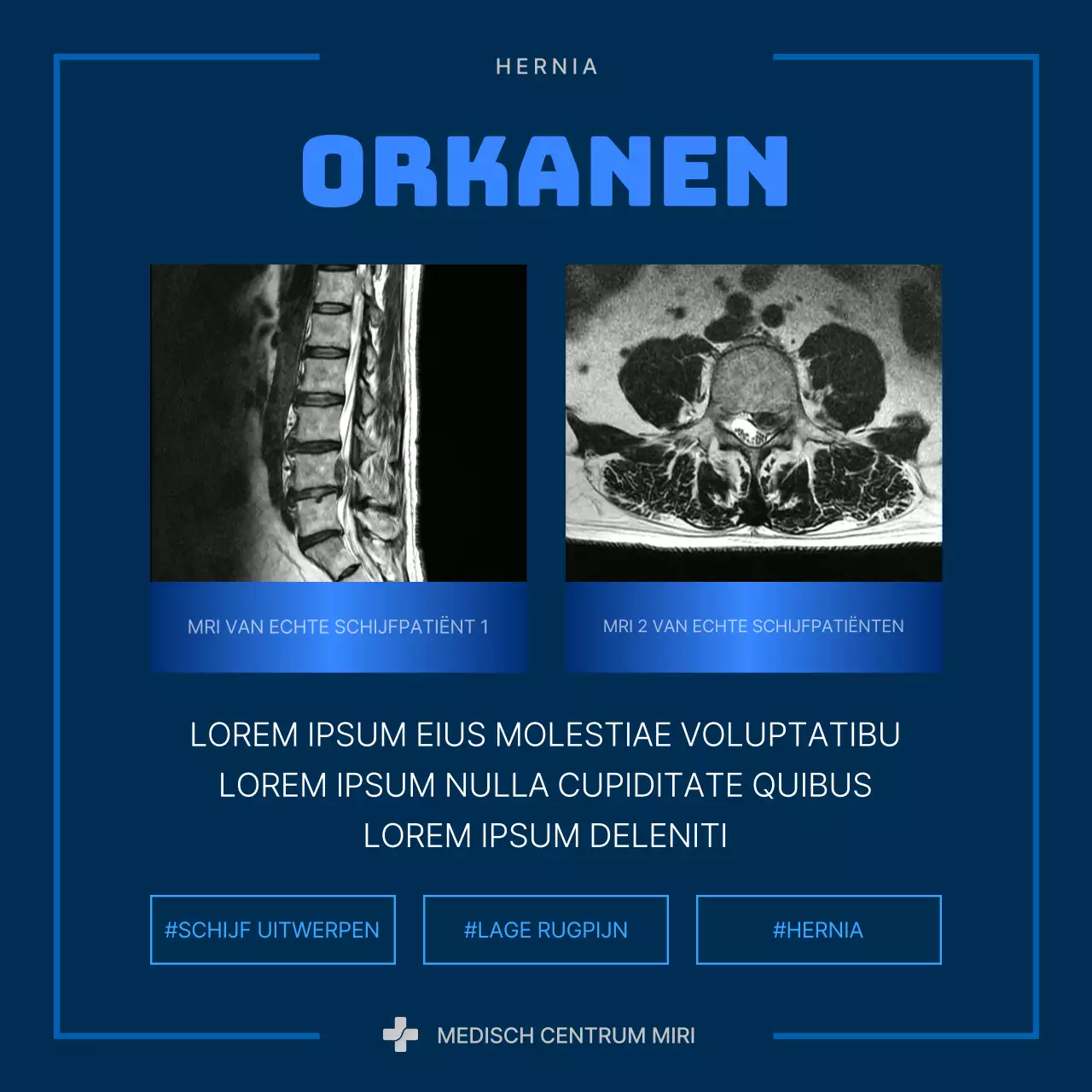 Over de blauwe en marine moderne hernia