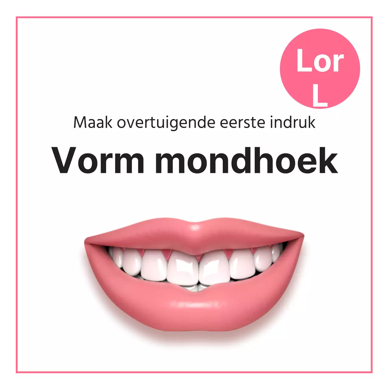 De mondhoek modelleren