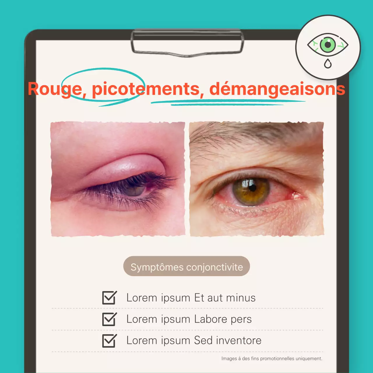 Informations sur les maladies estivales pour le turquoise et l'indigo