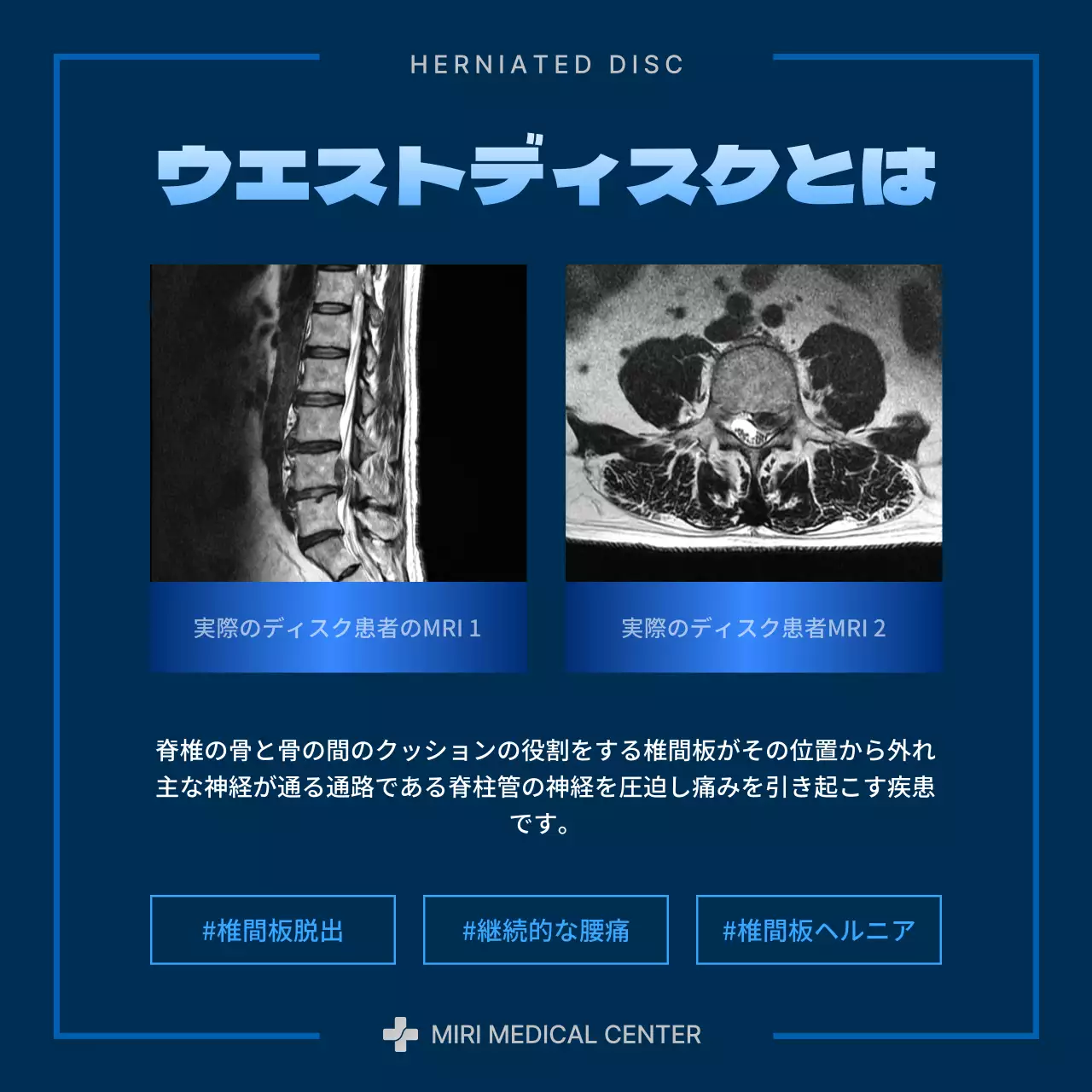 ブルーとネイビーのモダンなウエストディスク情報