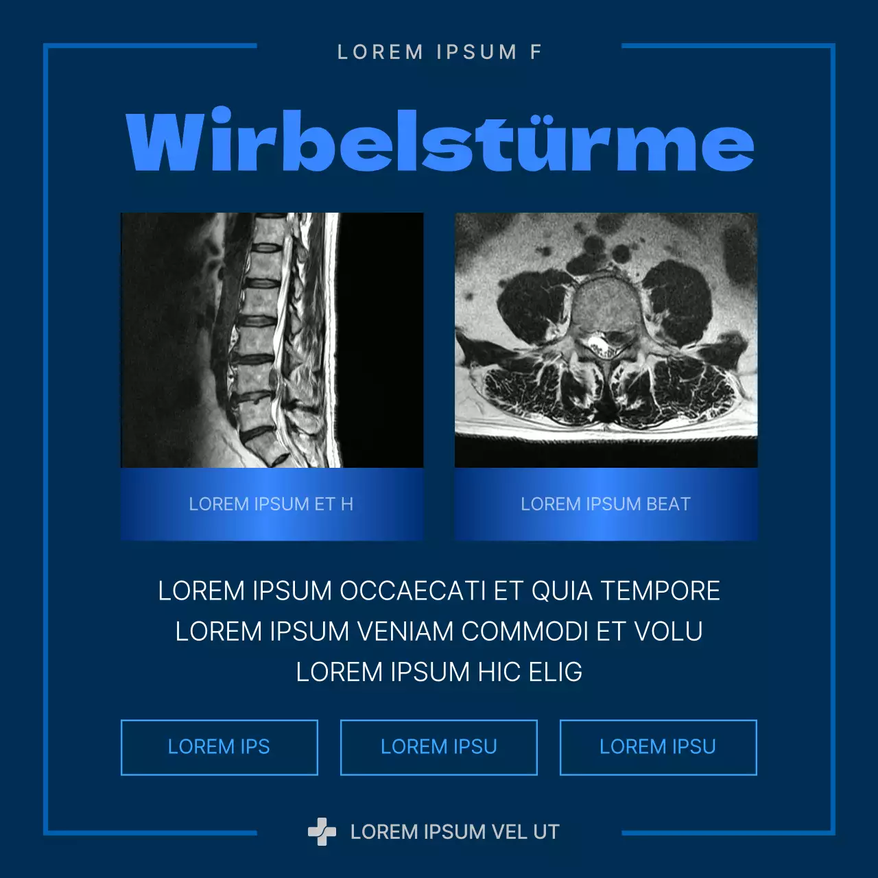 Über den modernen Bandscheibenvorfall in Blau und Marineblau