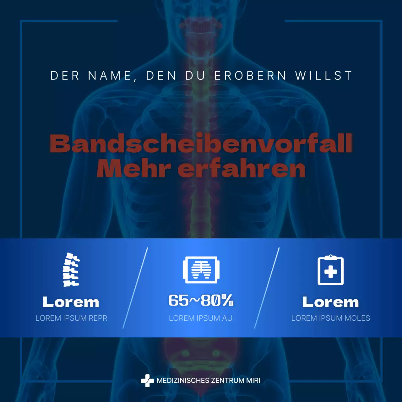 Über den modernen Bandscheibenvorfall in Blau und Marineblau