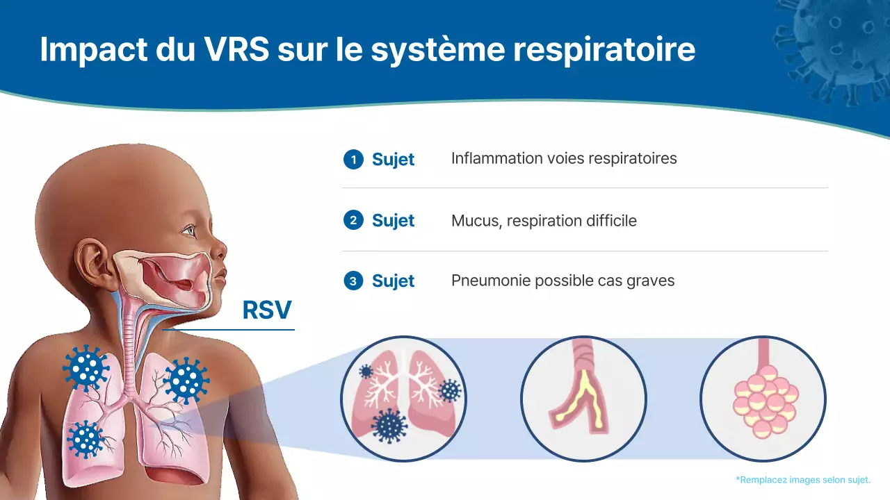 conférence sur les maladies respiratoires modernes bleues