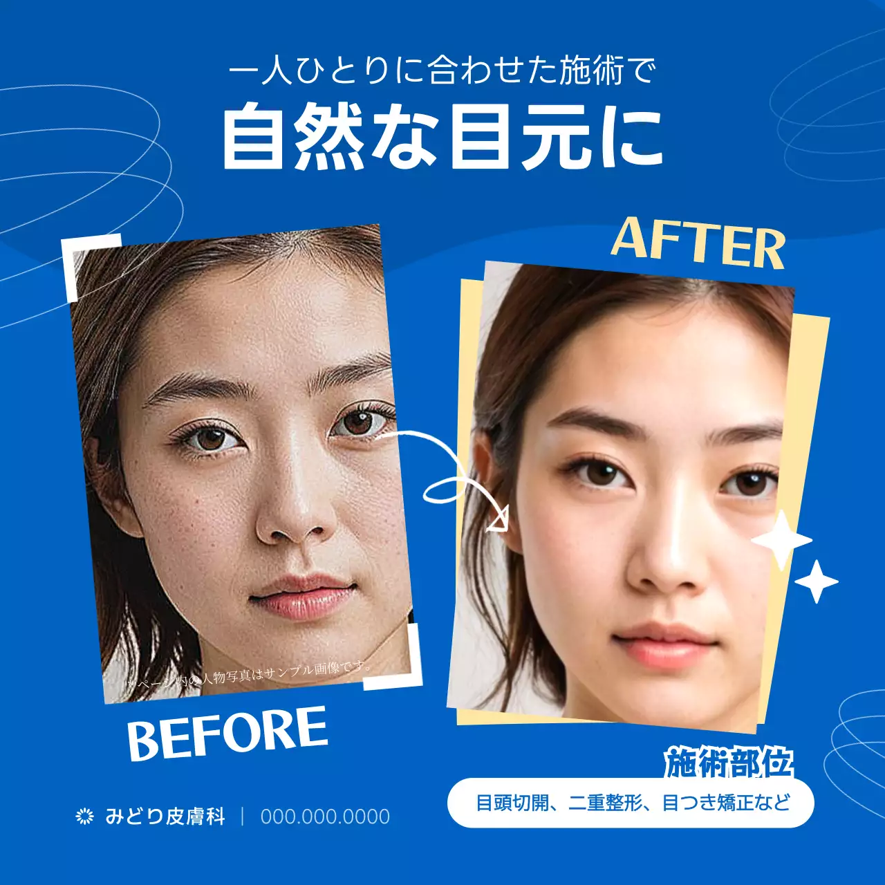 青 シンプル 美容 ポスター