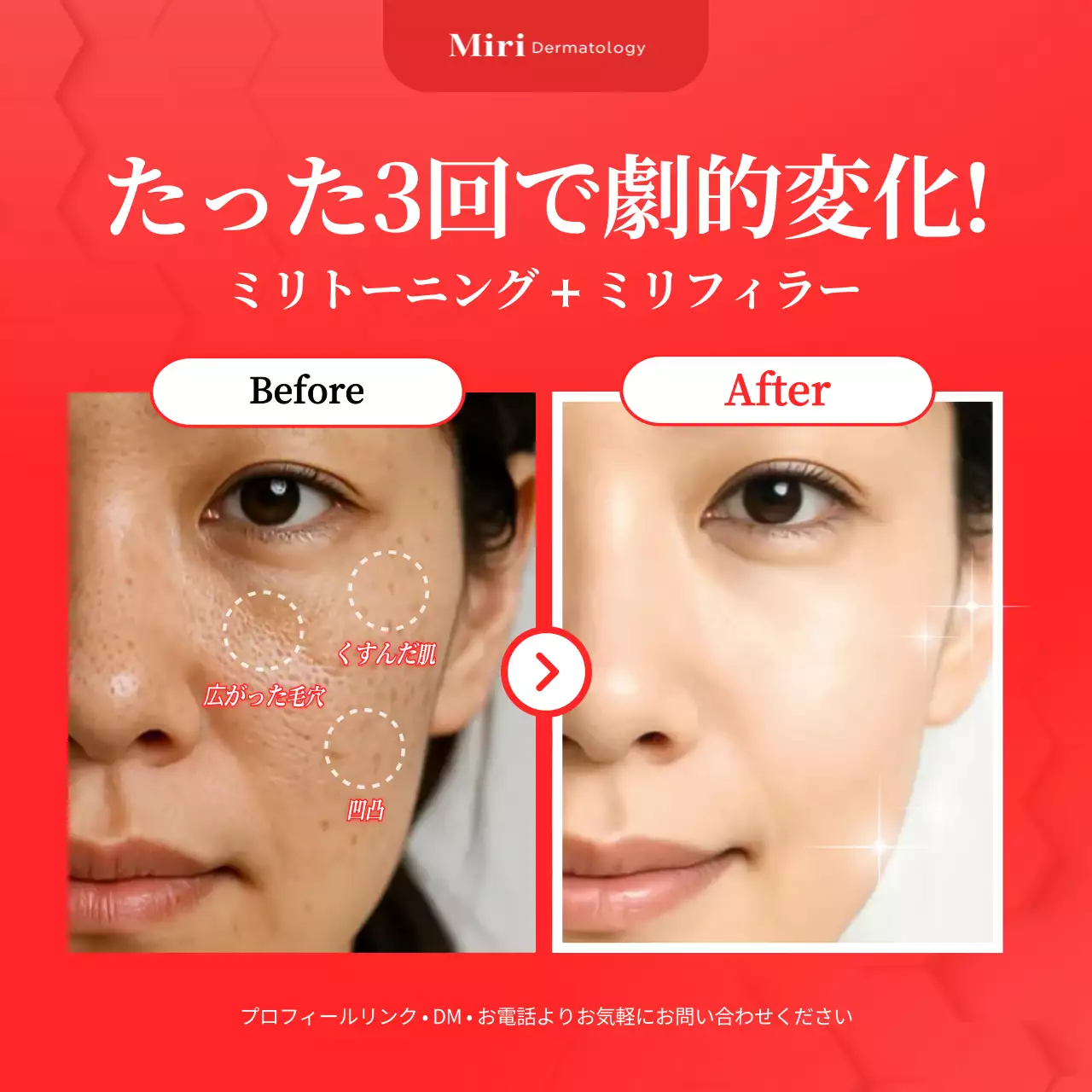 赤 モダン 美容広告 ポスター