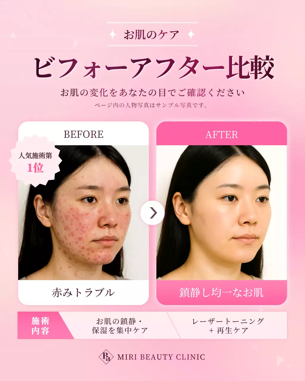 ピンク モダン 美容 ポスター