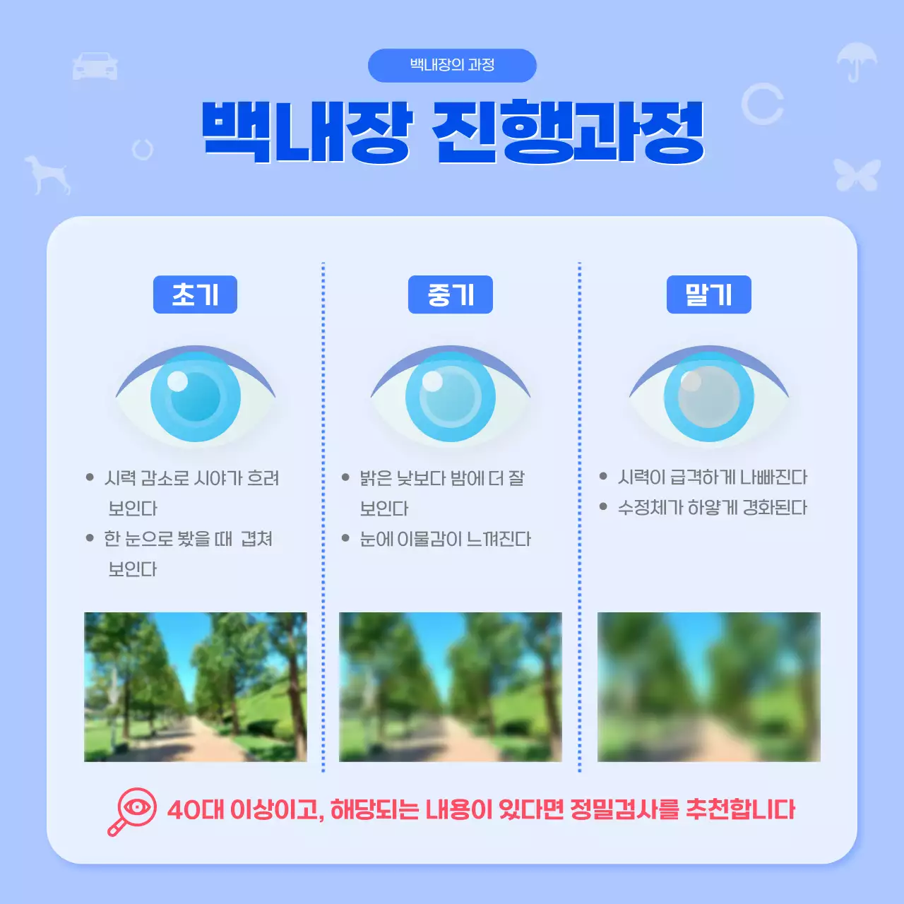 파란색의 심플한 백내장 정보안내