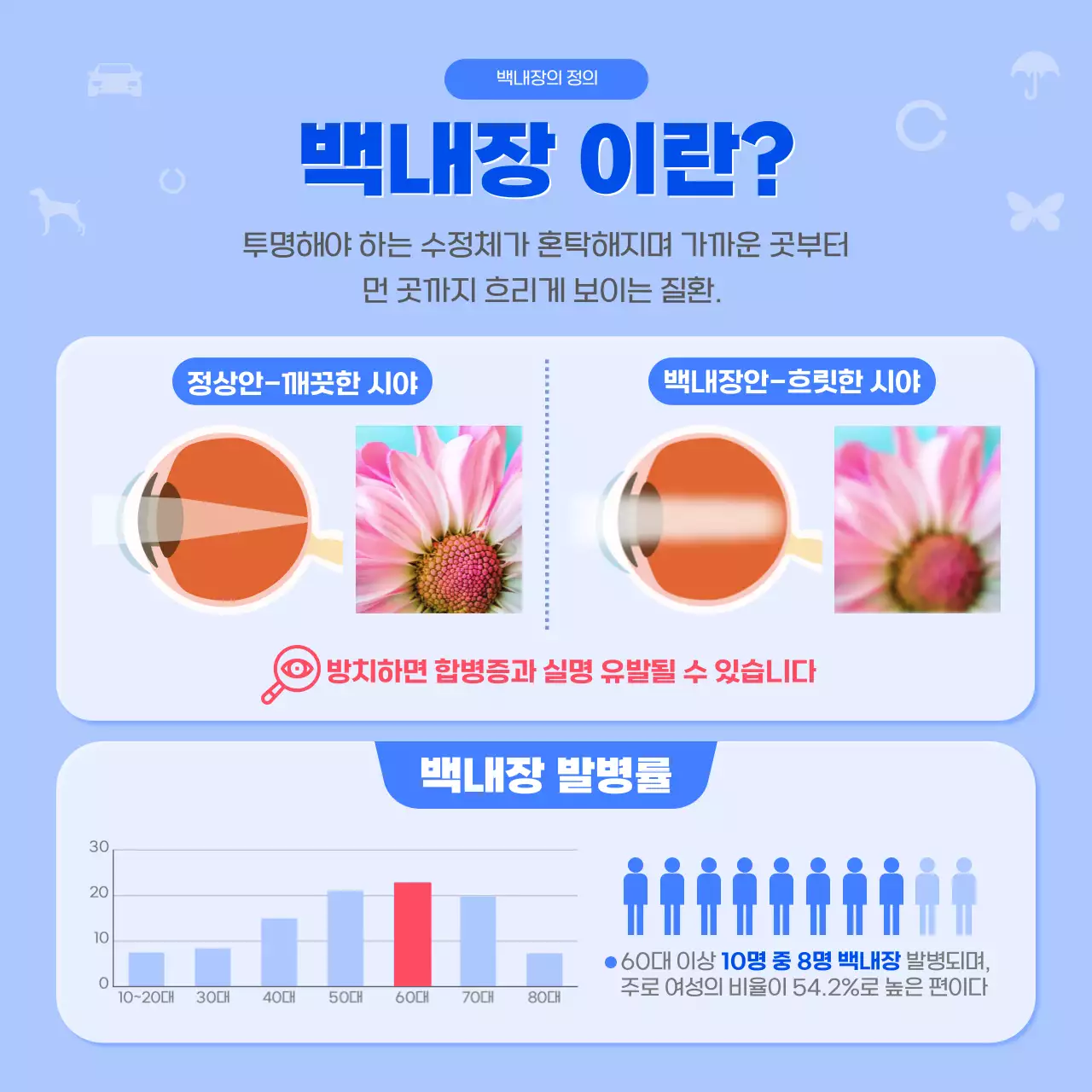 파란색의 심플한 백내장 정보안내