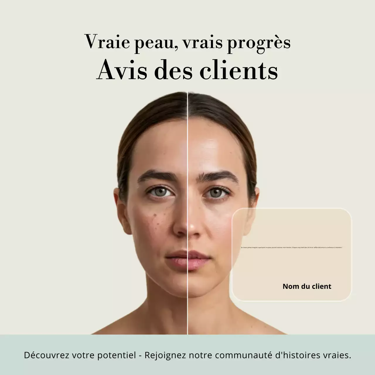Place des médias sociaux pour la promotion des soins de la peau beiges et modernes