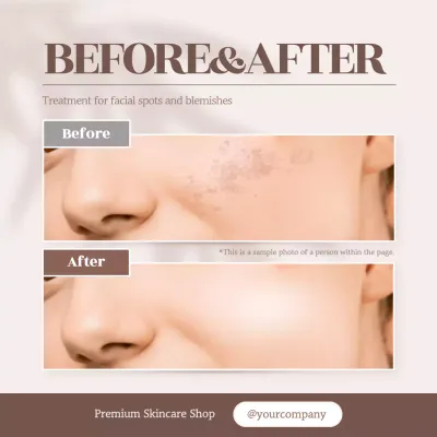 Beige Minimal Skincare Promotion Social Media Post