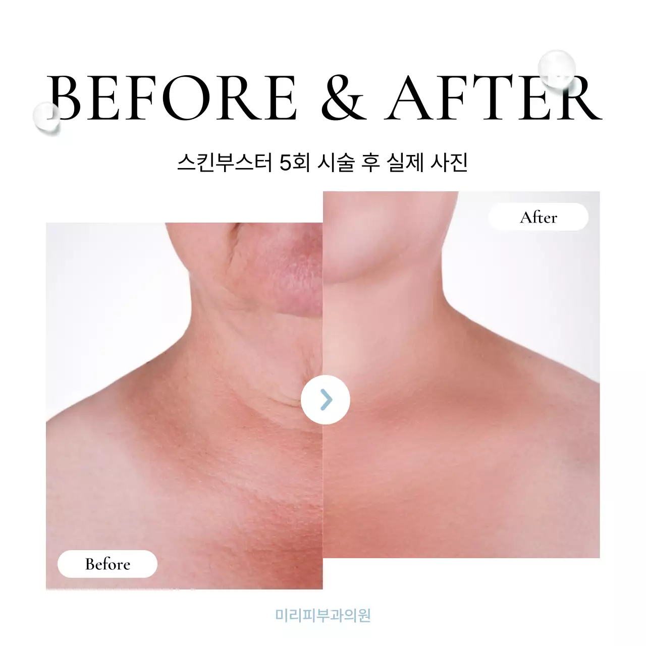 흰색과 하늘색의 심플한 피부과를 홍보하기위한 병원 마켓팅 sns 소셜미디어 키트 홍보