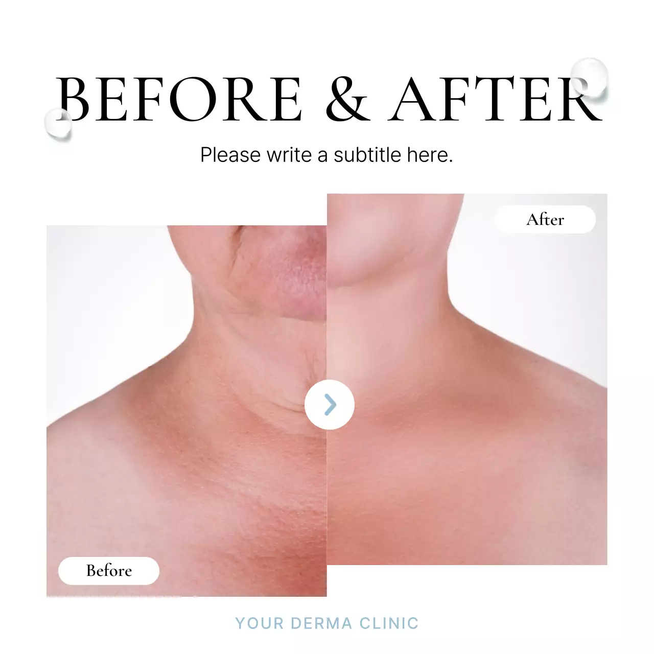 White Elegant Skin Marketing Instagram Carousel