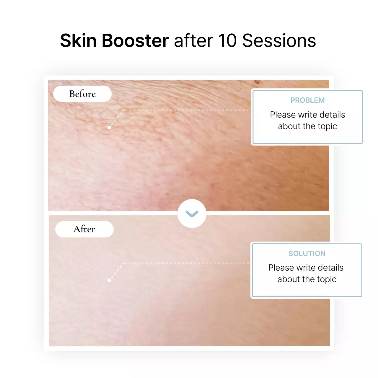 White Elegant Skin Marketing Instagram Carousel